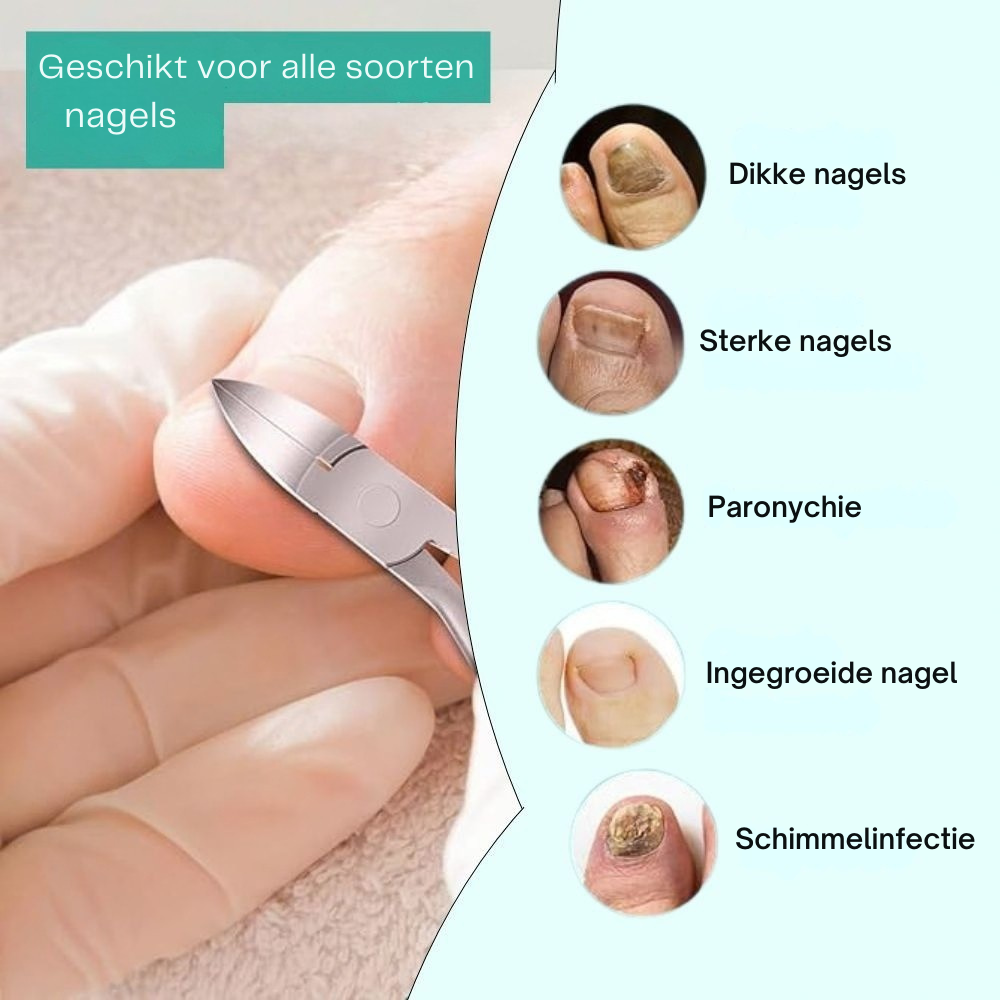 Professionele nagelknipper voor verdikte en schimmelnagels