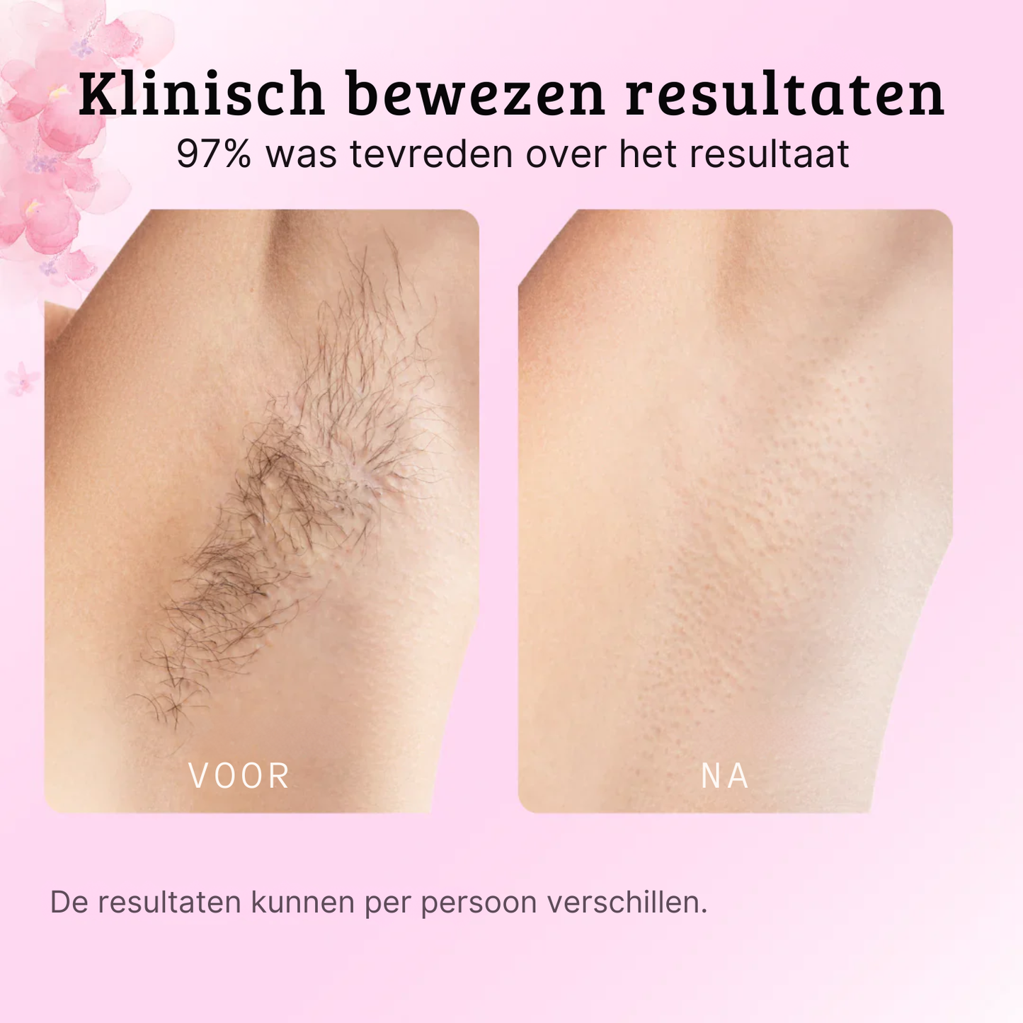 Mooibelle | Cyperus Rotundus-Olie