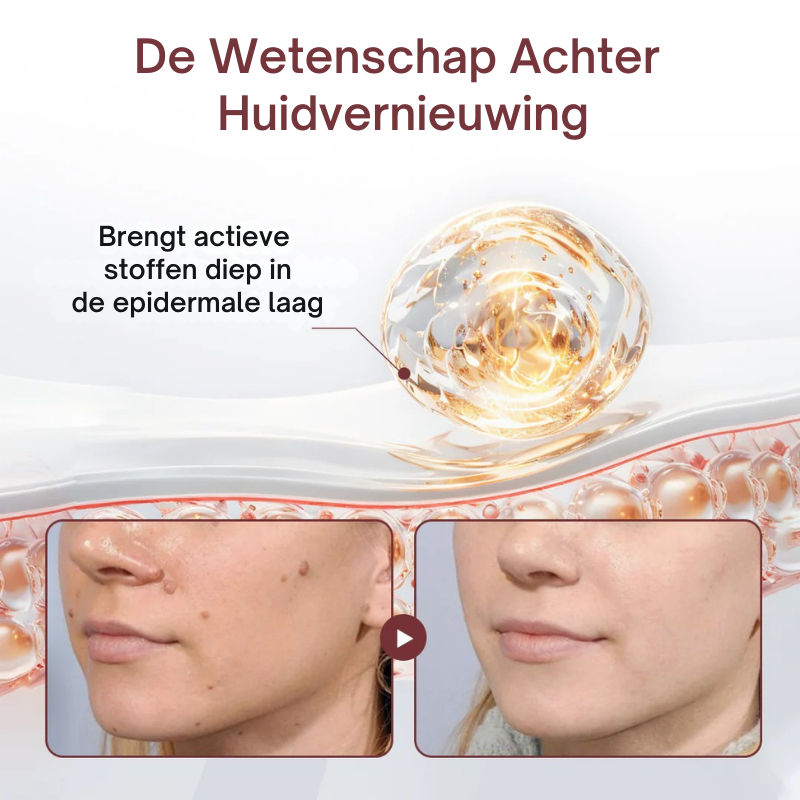 Biancat® KeraErase Dubbelwerkende Vernieuwingscrème by Mooibelle