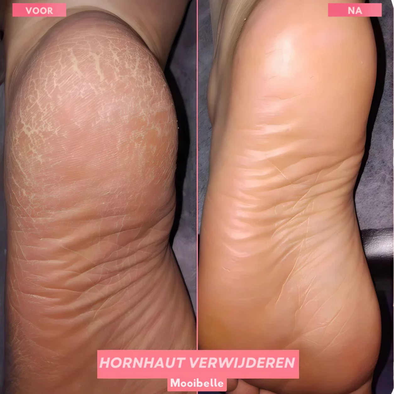 Mooibelle - FootGlow
