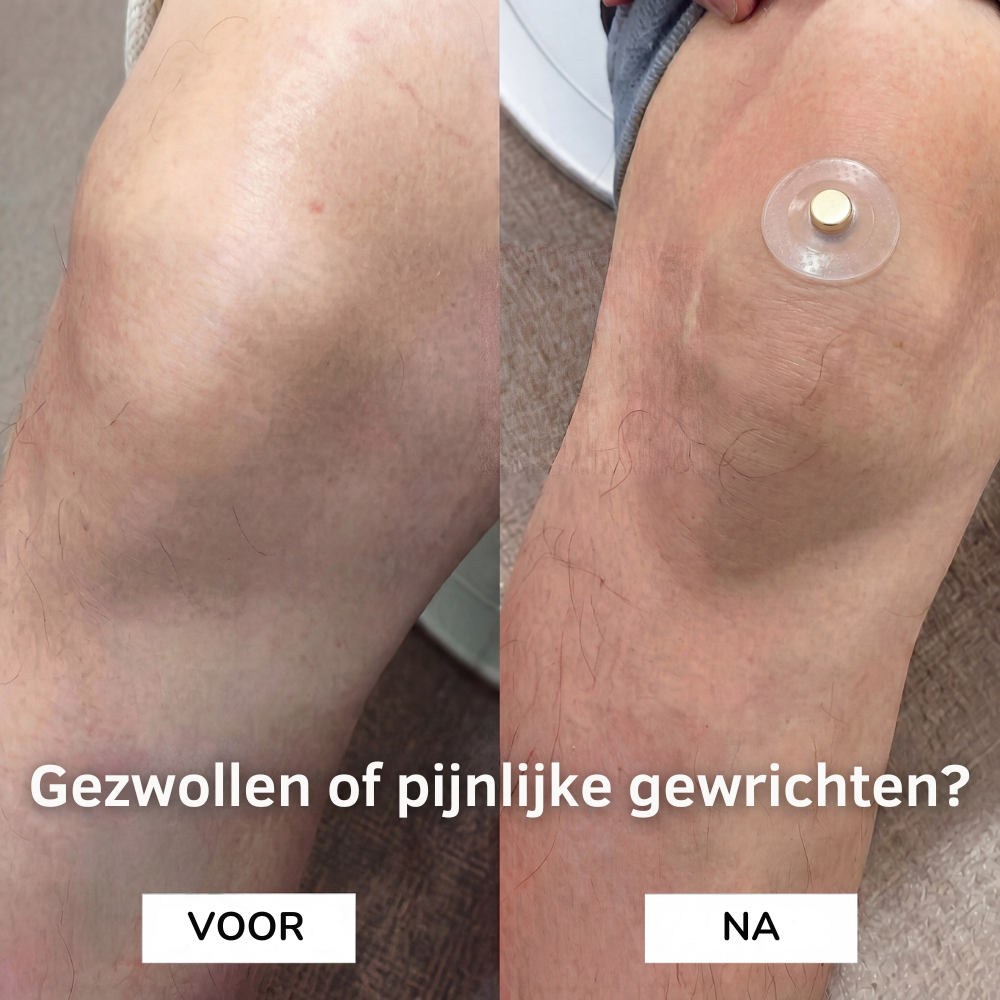 Magnetische acupressuurpleisters