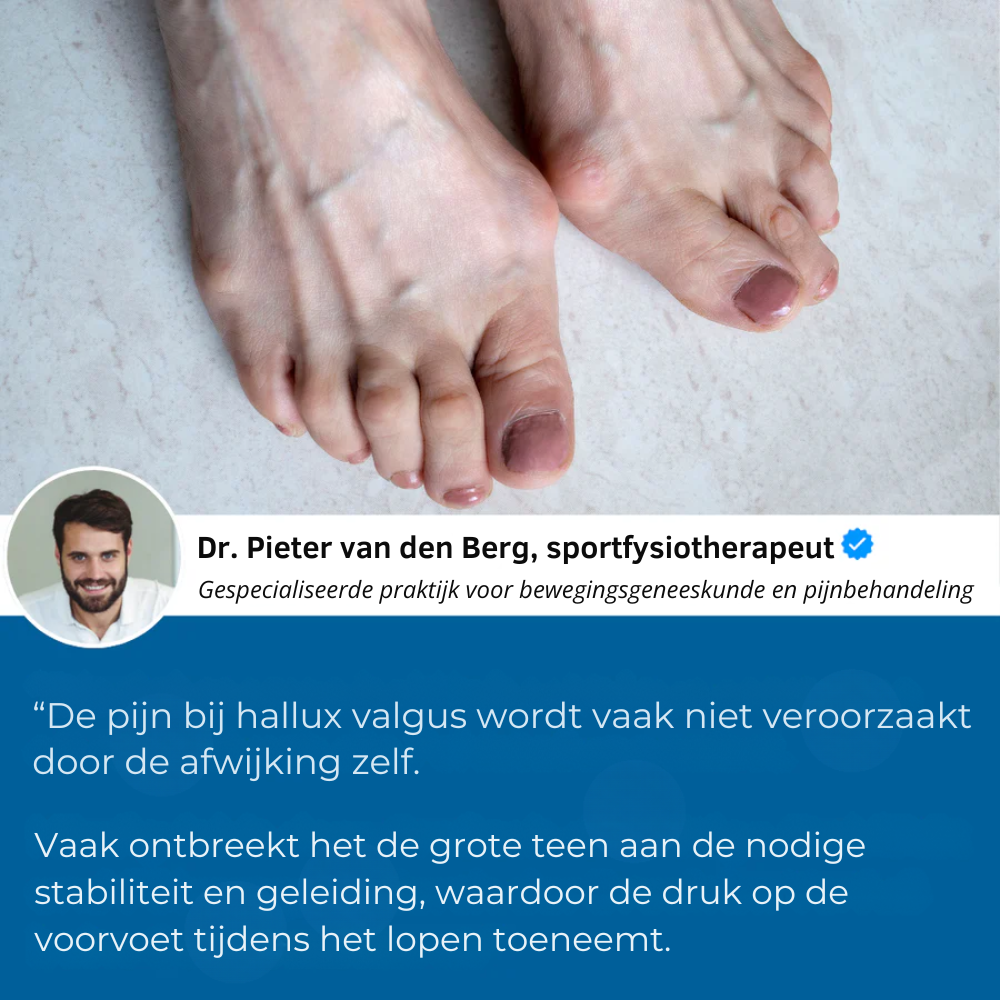 Mooibelle - Hallux-Valgus