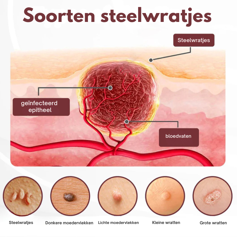 Biancat® KeraErase Dubbelwerkende Vernieuwingscrème by Mooibelle