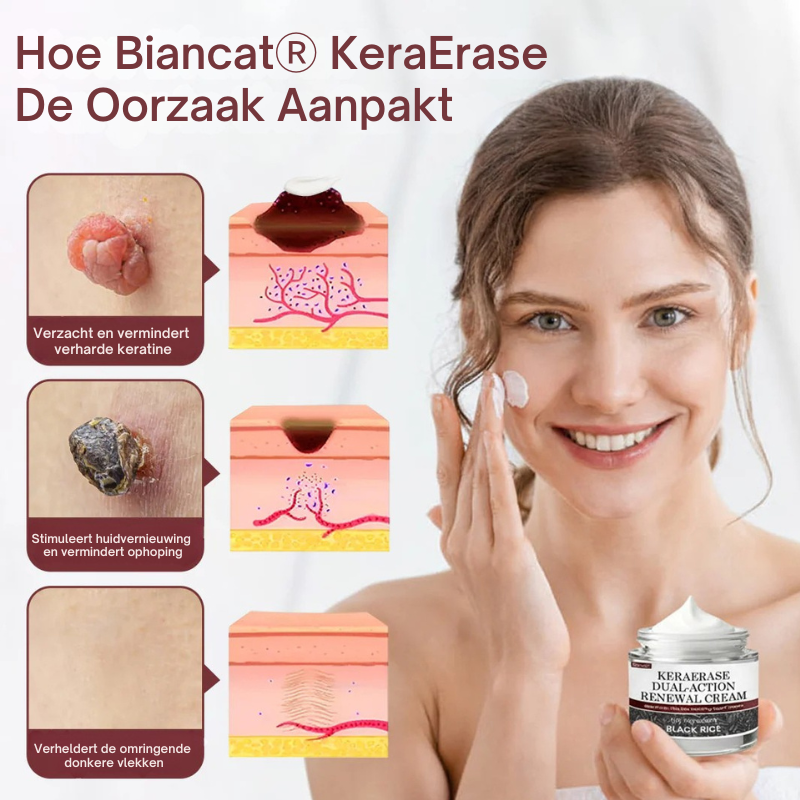 Biancat® KeraErase Dubbelwerkende Vernieuwingscrème by Mooibelle