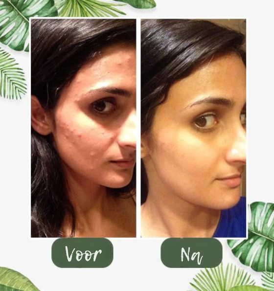 100% Natuurlijk Groene Thee Diep Reinigend Masker