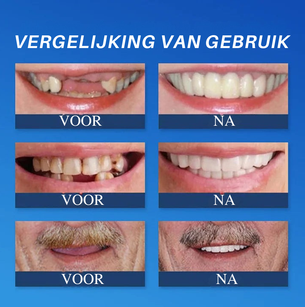 Mooibelle | Medisch volledig kunstgebit