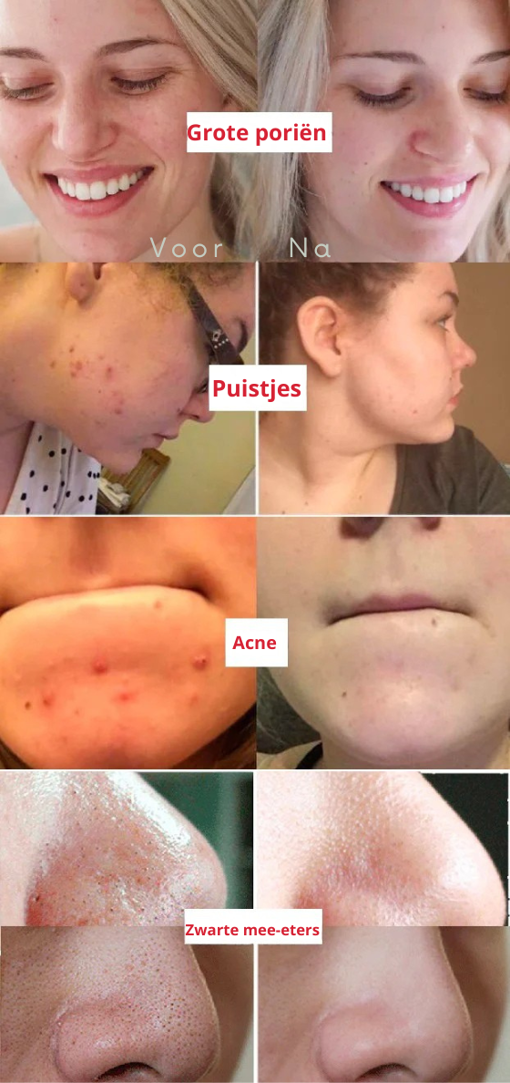 100% Natuurlijk Groene Thee Diep Reinigend Masker