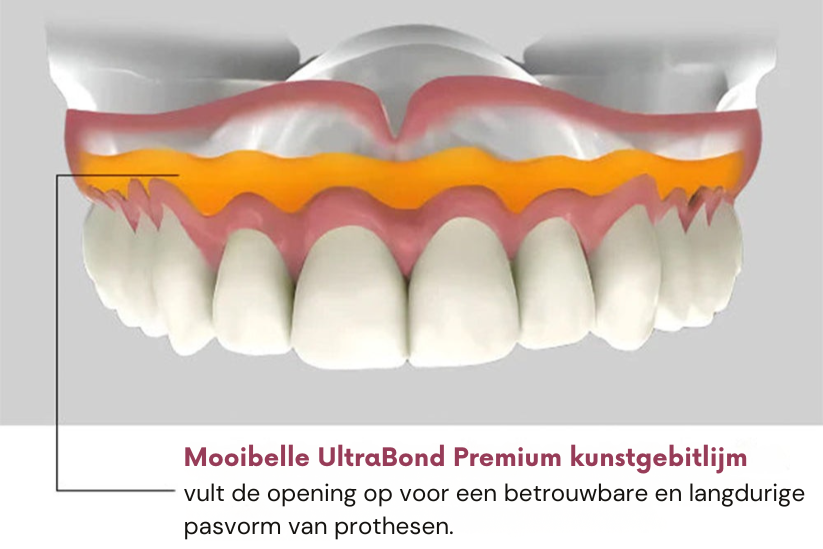 Mooibelle | UltraBond Premium kunstgebitlijm
