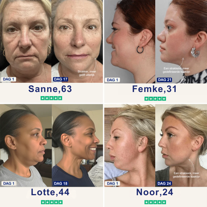 Mooibelle Kinliftmasker - Word weer de vrouw die van haar kaaklijn houdt